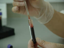Test tube and blood